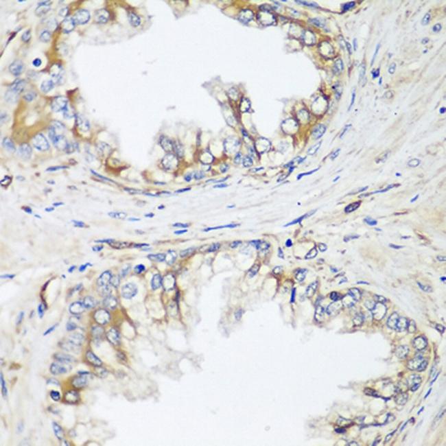 HPa2 Antibody in Immunohistochemistry (Paraffin) (IHC (P))