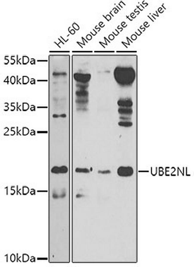 UBE2NL Antibody in Western Blot (WB)