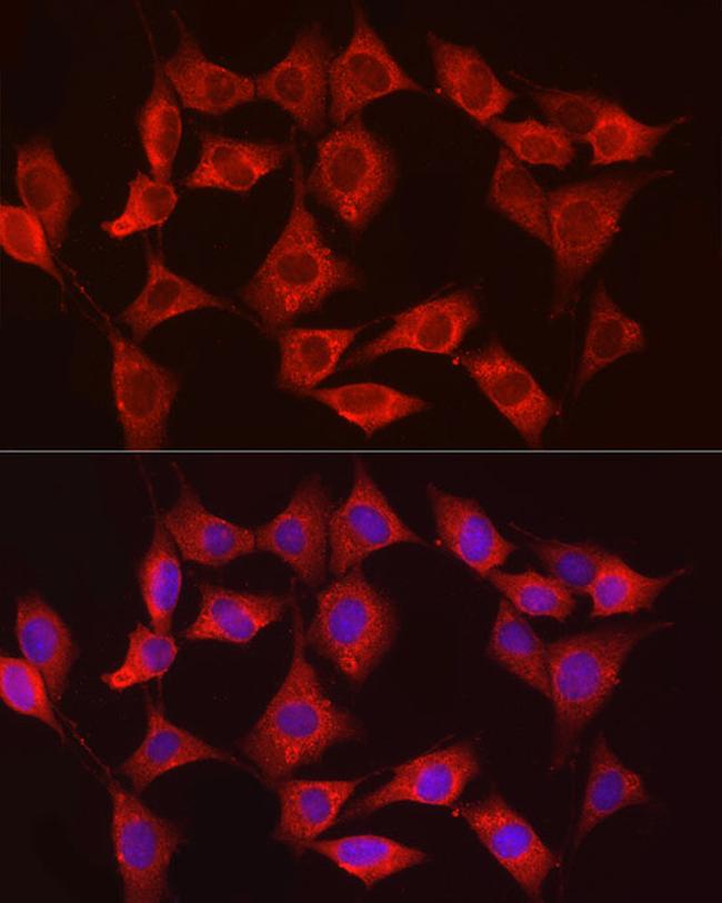 HK3 Antibody in Immunocytochemistry (ICC/IF)