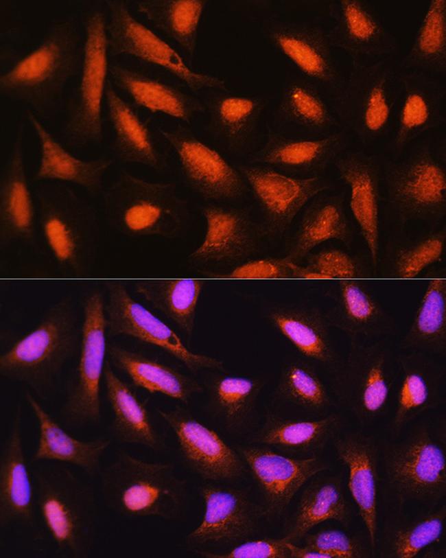 GMFB Antibody in Immunocytochemistry (ICC/IF)