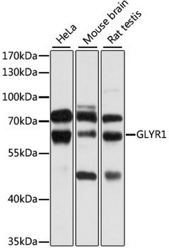 GLYR1 Antibody in Western Blot (WB)