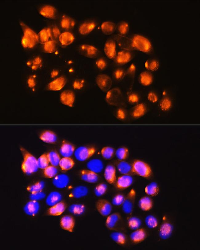 EPB41L2 Antibody in Immunocytochemistry (ICC/IF)