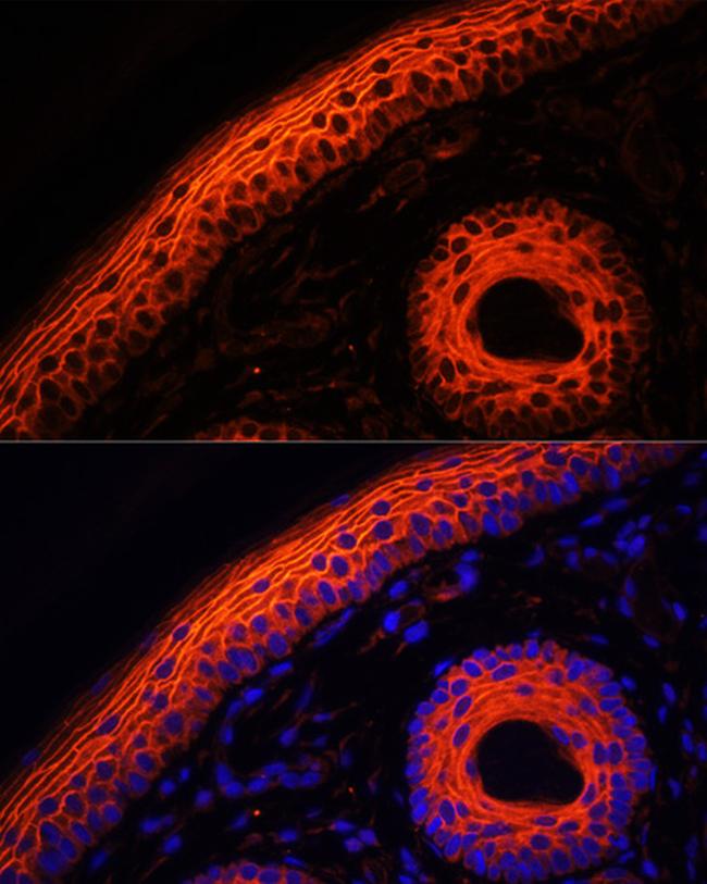 Desmoglein 1 Antibody in Immunohistochemistry (Paraffin) (IHC (P))