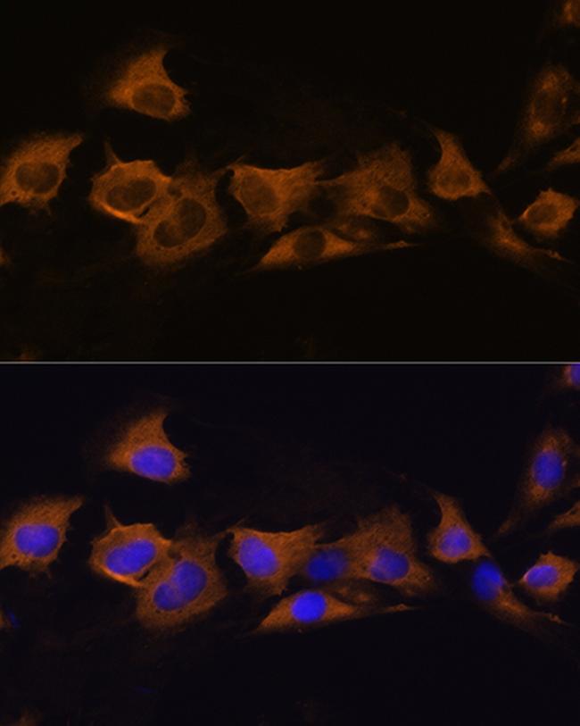 ATP1B2 Antibody in Immunocytochemistry (ICC/IF)