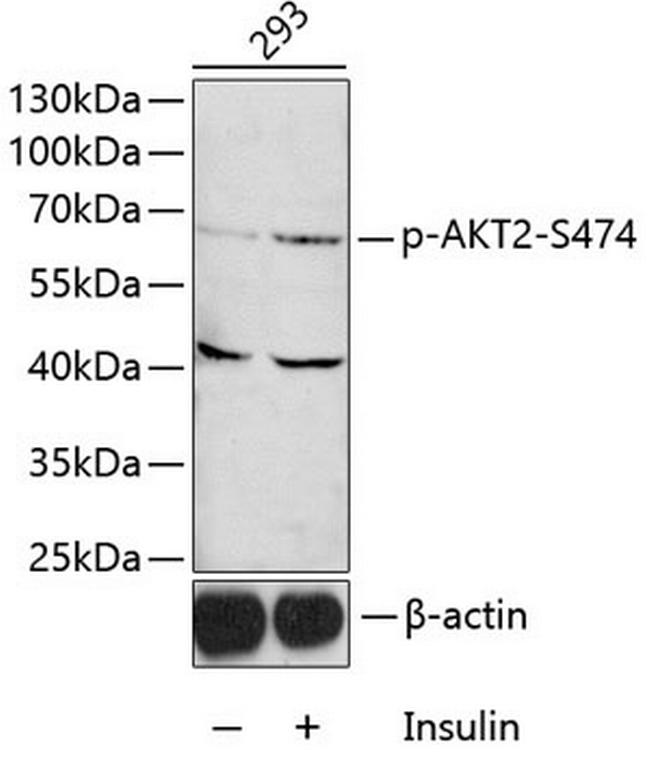 Phospho-AKT2 (Ser474) Antibody in Western Blot (WB)