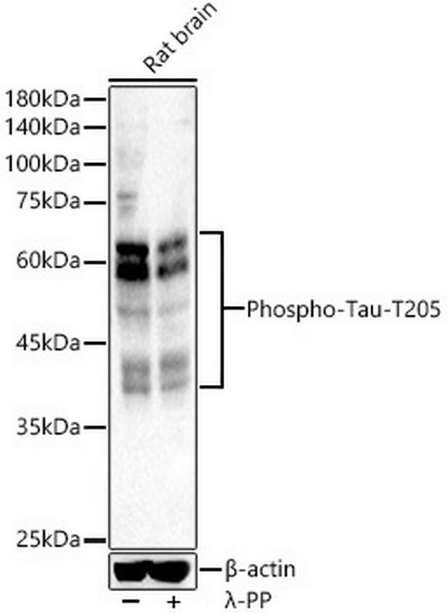 Phospho-Tau (Thr205) Antibody in Western Blot (WB)