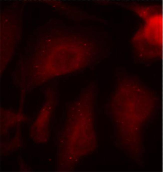 Phospho-Tau (Ser404) Antibody in Immunocytochemistry (ICC/IF)