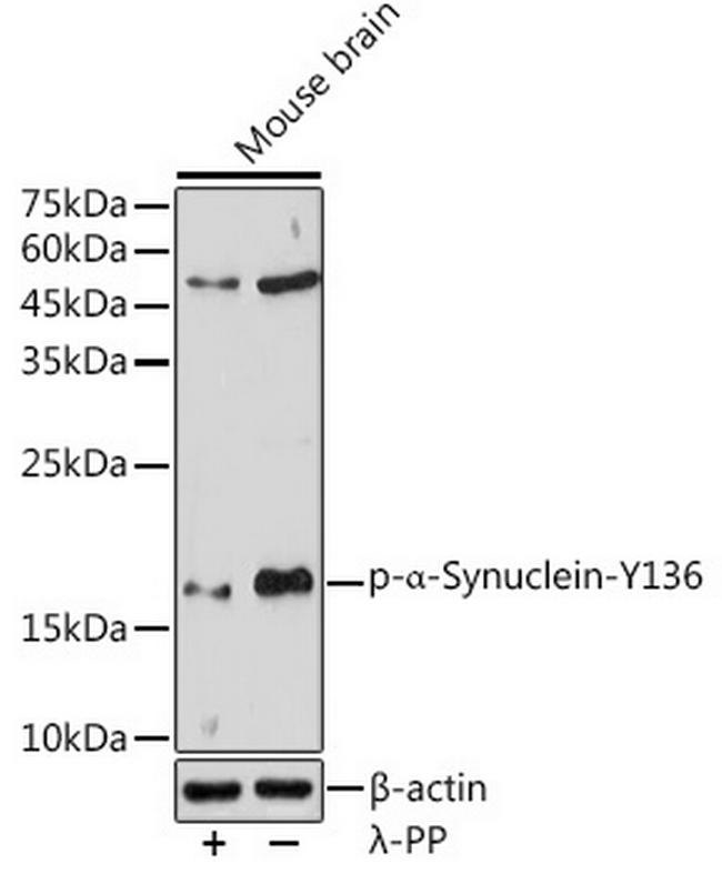 Phospho-alpha Synuclein (Tyr136) Antibody in Western Blot (WB)