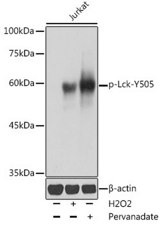 Phospho-LCK (Tyr505) Antibody in Western Blot (WB)