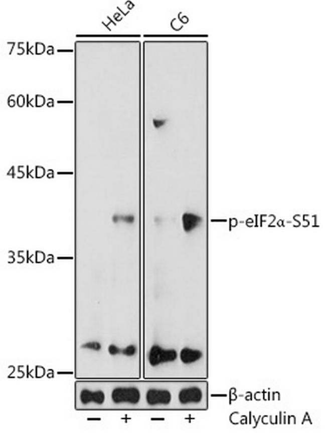 Phospho-EIF2S1 (Ser51) Antibody in Western Blot (WB)