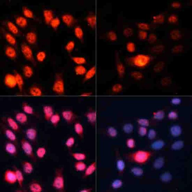 Phospho-p70 S6 Kinase (Thr389) Antibody in Immunocytochemistry (ICC/IF)