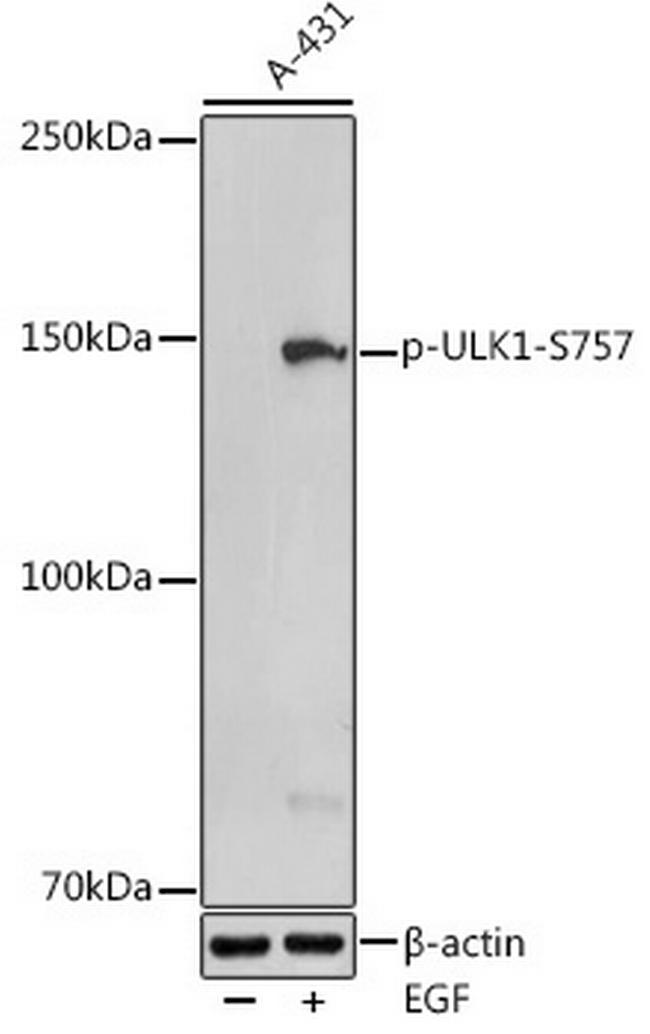 Phospho-ULK1 (Ser757) Antibody in Western Blot (WB)