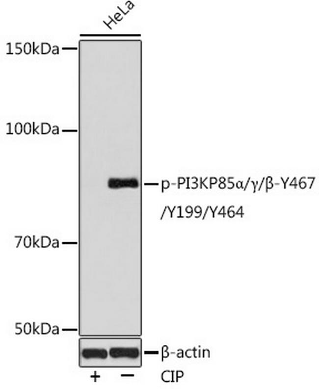 Phospho-PI3K p85/p55 (Tyr467, Tyr199, Tyr464) Antibody in Western Blot (WB)