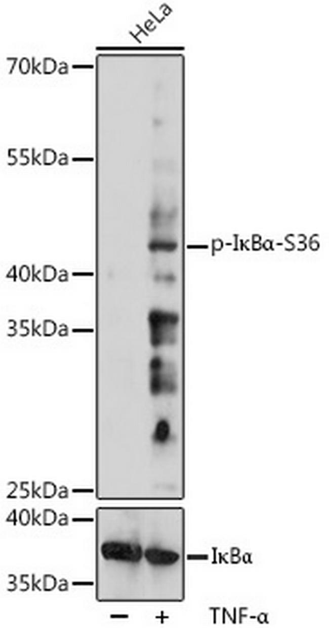 Phospho-IkB alpha (Ser36) Antibody in Western Blot (WB)