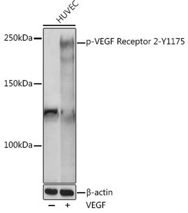 Phospho-VEGF Receptor 2 (Tyr1175) Antibody in Western Blot (WB)