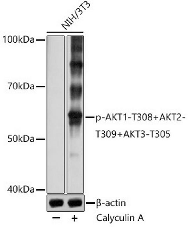 Phospho-AKT Pan (Thr308, Thr305, Thr309) Antibody in Western Blot (WB)