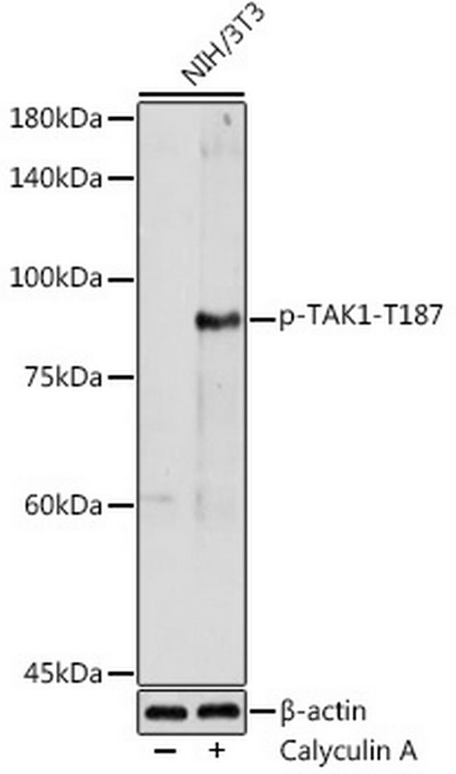 Phospho-TAK1 (Thr187) Antibody in Western Blot (WB)