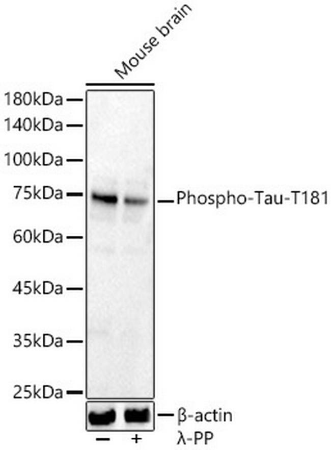 Phospho-Tau (Thr181) Antibody in Western Blot (WB)