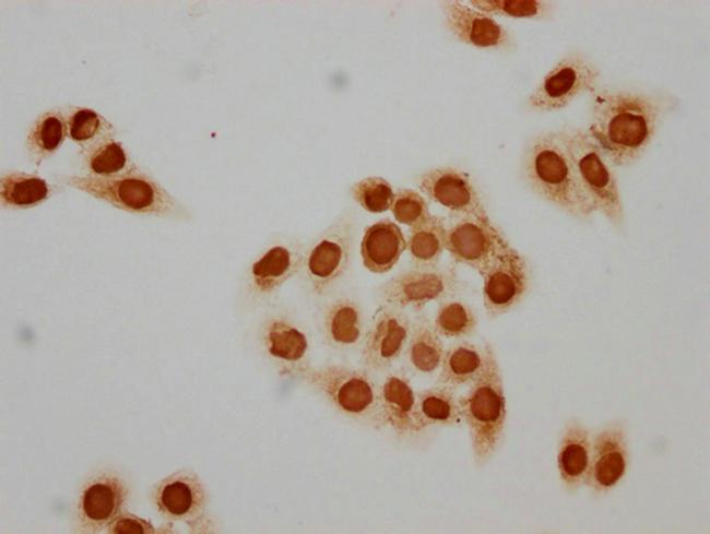 Acetyl-Histone H1.2 (Lys89) Antibody in Immunocytochemistry (ICC/IF)