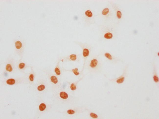 Acetyl-Histone H1.4 (Lys45) Antibody in Immunocytochemistry (ICC/IF)