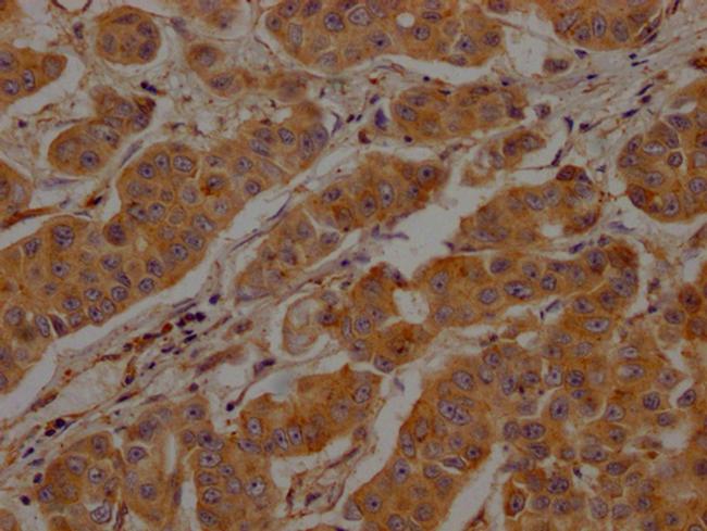 Clathrin Heavy Chain Antibody in Immunohistochemistry (Paraffin) (IHC (P))