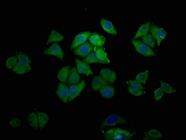 Epiregulin Antibody in Immunocytochemistry (ICC/IF)