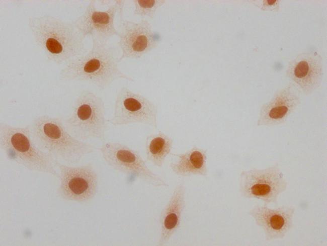 Formyl-Histone H1.4 (Lys63) Antibody in Immunocytochemistry (ICC/IF)