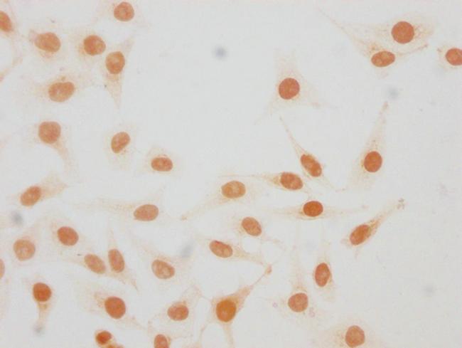 Mono-Methyl-Histone H1.4 (Lys25) Antibody in Immunocytochemistry (ICC/IF)