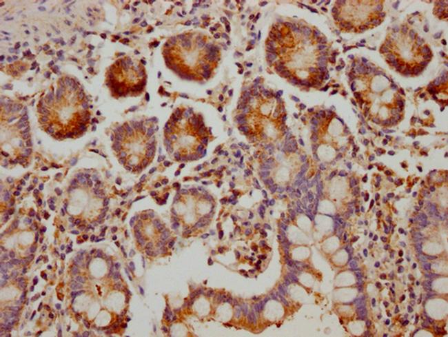 MUC5B Antibody in Immunohistochemistry (Paraffin) (IHC (P))