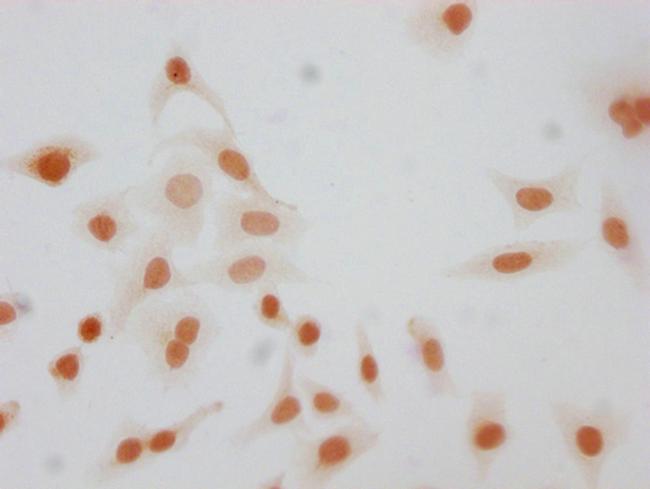 Phospho-Histone H1.4 (Ser26) Antibody in Immunocytochemistry (ICC/IF)