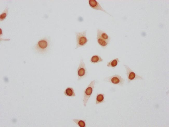 Phospho-Histone H1.4 (Thr17) Antibody in Immunocytochemistry (ICC/IF)