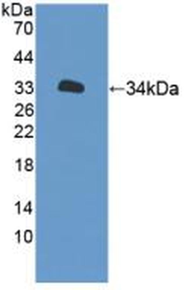 XYLT2 Antibody in Western Blot (WB)