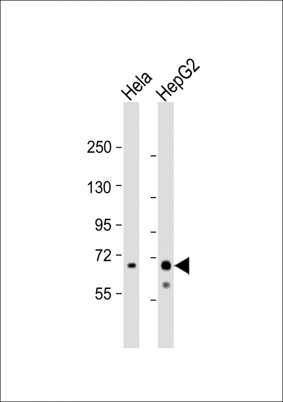 Ribophorin I Antibody in Western Blot (WB)