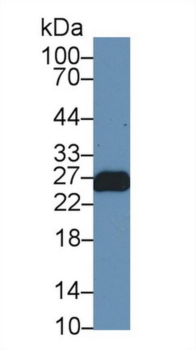 Troponin I Antibody in Western Blot (WB)