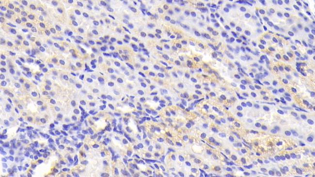 Tankyrase 2 Antibody in Immunohistochemistry (Paraffin) (IHC (P))