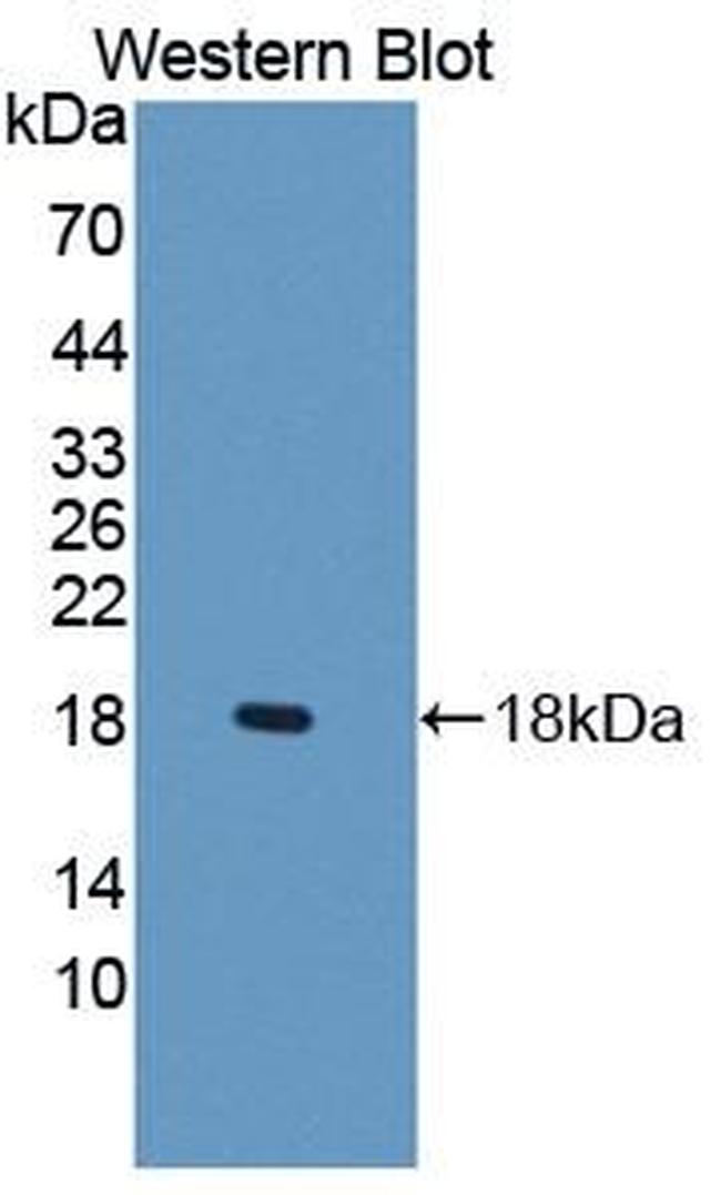 SLC22A4 Antibody in Western Blot (WB)