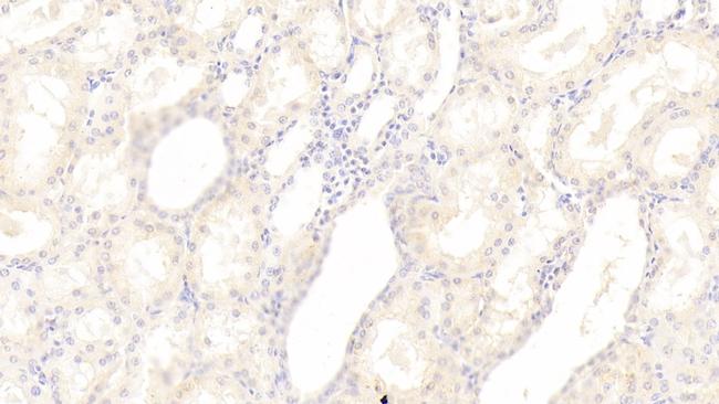 SGPL1 Antibody in Immunohistochemistry (Paraffin) (IHC (P))