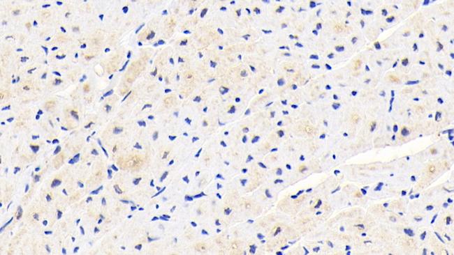 PLOD1 Antibody in Immunohistochemistry (Paraffin) (IHC (P))