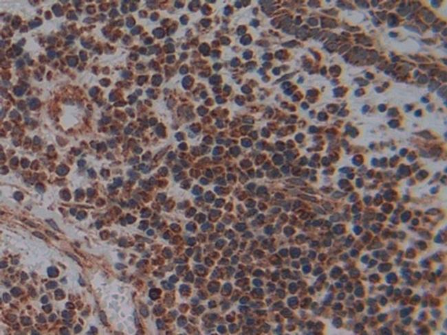 PLAA Antibody in Immunohistochemistry (Paraffin) (IHC (P))