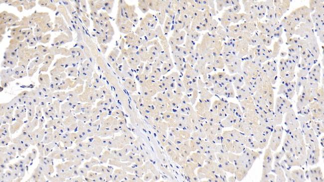 ITGA11 Antibody in Immunohistochemistry (Paraffin) (IHC (P))