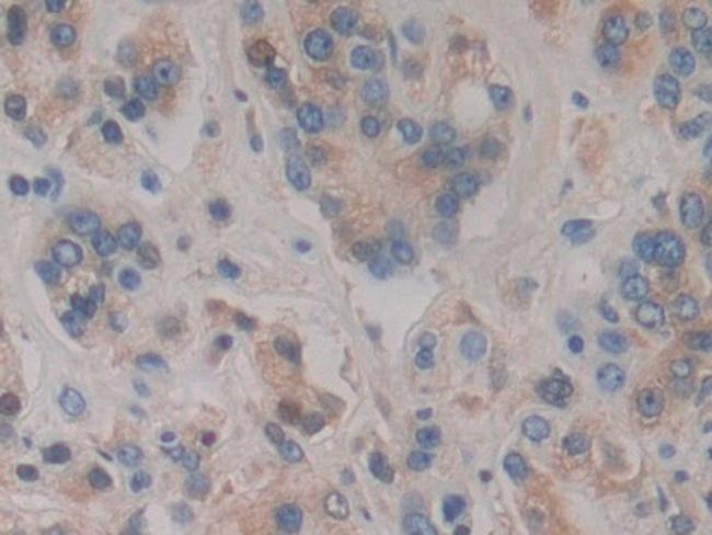 HPR Antibody in Immunohistochemistry (Paraffin) (IHC (P))