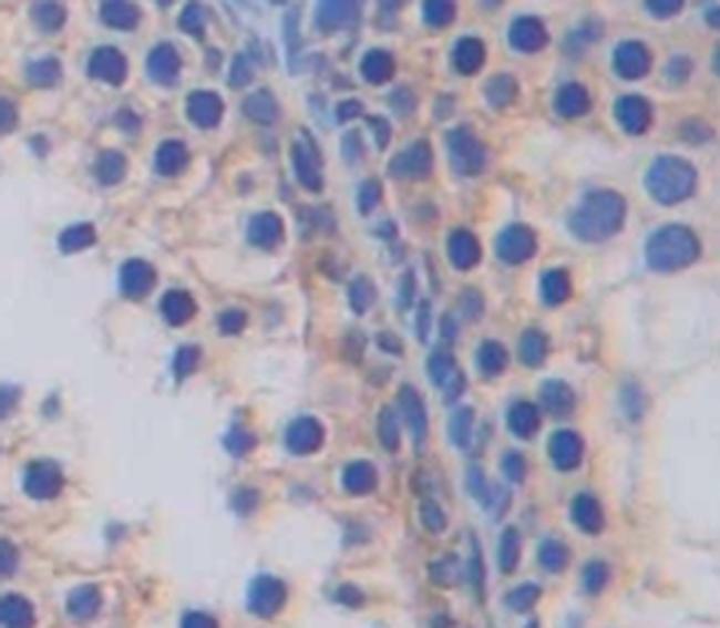 GLUT14 Antibody in Immunohistochemistry (Paraffin) (IHC (P))