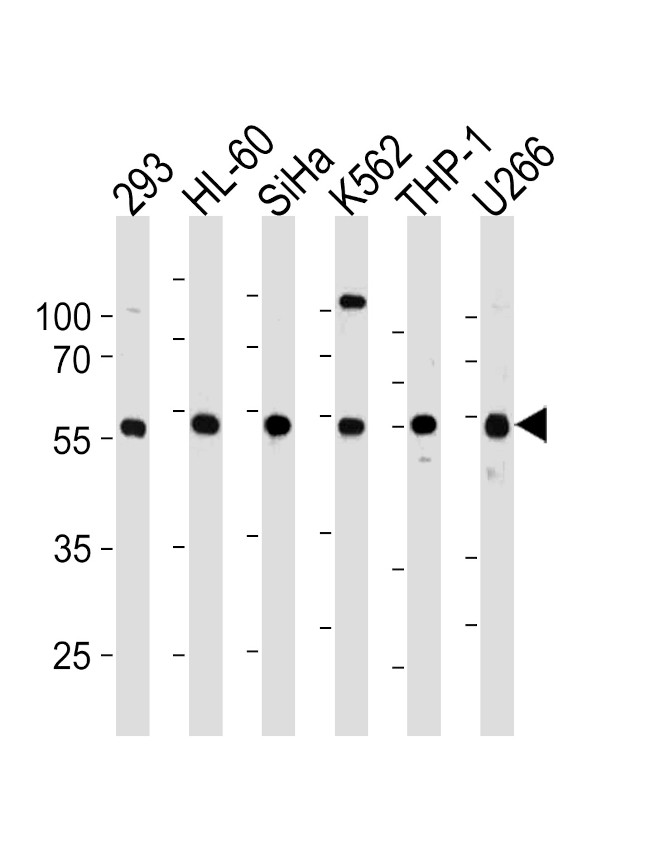 YY1 Antibody in Western Blot (WB)