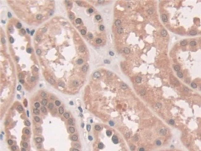 ATP7B Antibody in Immunohistochemistry (Paraffin) (IHC (P))