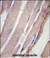 PHPT1 Antibody in Immunohistochemistry (Paraffin) (IHC (P))