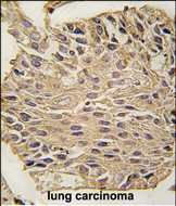 Aldolase A Antibody in Immunohistochemistry (Paraffin) (IHC (P))