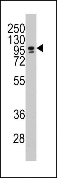 C/EBP zeta Antibody in Western Blot (WB)