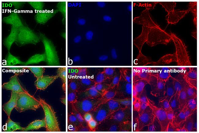 IDO Antibody in Immunocytochemistry (ICC/IF)