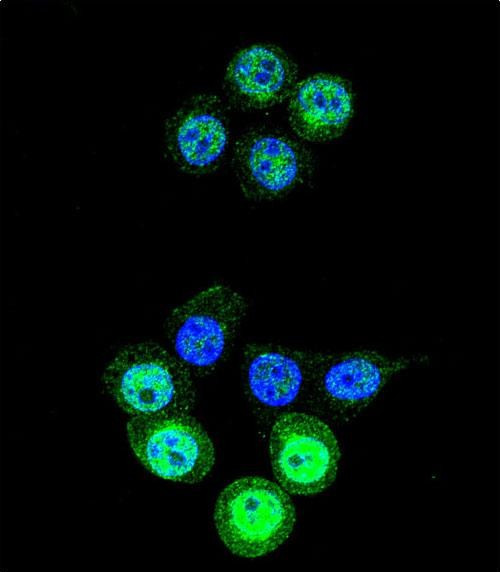 AKR1B1 Antibody in Immunocytochemistry (ICC/IF)