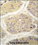 beta-2 Microglobulin Antibody in Immunohistochemistry (Paraffin) (IHC (P))